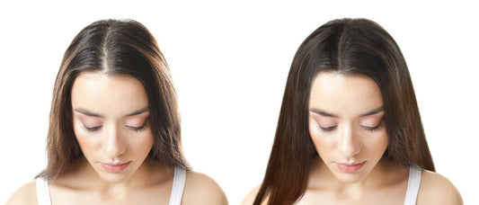 Hair Extensions and Scalp Health